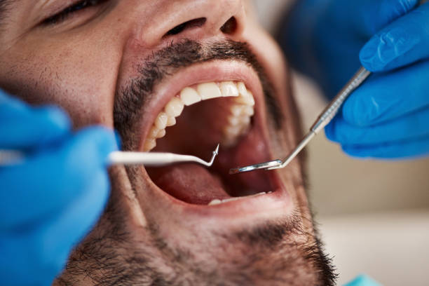 Best Dentist for Tooth Abscess  in Redway, CA